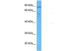 Host:  Rabbit  Target Name:  LETM1  Sample Type:  MDA-MB-435s Whole Cell lysates  Antibody Dilution:  1. (LETM1 antibody  (C-Term))