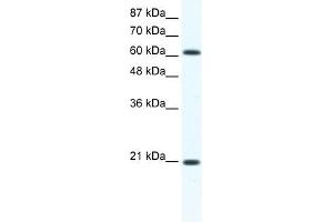 Annexin A6 antibody used at 1. (ANXA6 antibody  (C-Term))