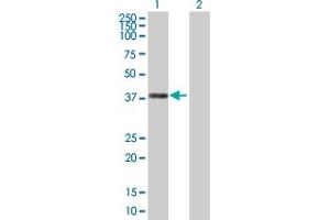 Western Blot analysis of JMJD7-PLA2G4B expression in transfected 293T cell line ( H00008681-T01 ) by JMJD7-PLA2G4B MaxPab polyclonal antibody. (JMJD7-PLA2G4B antibody  (AA 1-316))