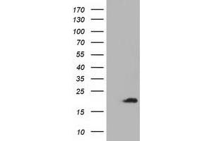 HEK293T cells were transfected with the pCMV6-ENTRY control (Left lane) or pCMV6-ENTRY ADI1 (Right lane) cDNA for 48 hrs and lysed. (ADI1 antibody)