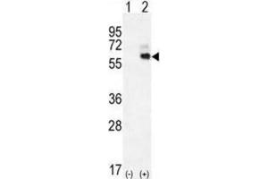Western Blotting (WB) image for anti-Kininogen 1 (KNG1) antibody (ABIN2996315)