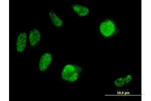 Immunofluorescence of purified MaxPab antibody to IRX2 on HeLa cell. (IRX2 antibody  (AA 1-471))
