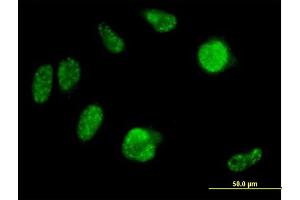 Immunofluorescence of purified MaxPab antibody to IRX2 on HeLa cell.