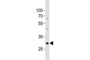 Western blot analysis of lysate from mouse kidney tissue lysate using Hes1 antibody diluted at 1:500. (HES1 antibody  (C-Term))