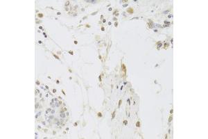 Immunohistochemistry of paraffin-embedded human breast using USP7 Antibody (ABIN5971305) at dilution of 1/100 (40x lens). (USP7 antibody)