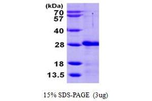 SDS-PAGE (SDS) image for Calcium And Integrin Binding Family Member 2 (CIB2) (AA 1-187) protein (His tag) (ABIN667347)