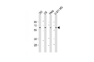 All lanes : Anti-YY1 Antibody (Center) at 1:500-1:1000 dilution Lane 1: 293 whole cell lysate Lane 2: C6 whole cell lysate Lane 3: Hela whole cell lysate Lane 4: U-251 MG whole cell lysate Lysates/proteins at 20 μg per lane.