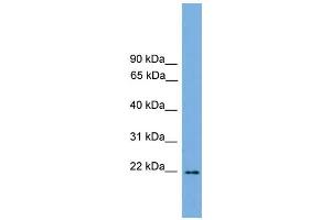WB Suggested Anti-Jundm2 Antibody Titration:  0.