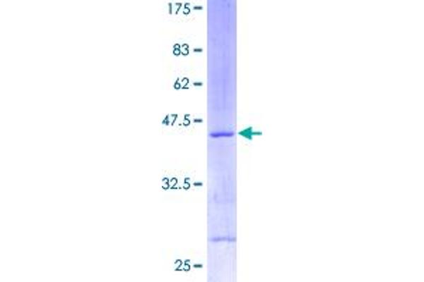 RPS13 Protein (AA 1-151) (GST tag)