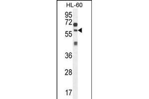 ZSWIM1 Antibody (C-term) (ABIN654558 and ABIN2844265) western blot analysis in HL-60 cell line lysates (35 μg/lane). (ZSWIM1 antibody  (C-Term))