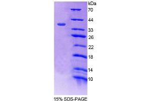 SDS-PAGE (SDS) image for Atrophin 1 (ATN1) (AA 879-1190) protein (His tag) (ABIN4989079)