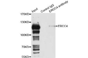 Immunoprecipitation analysis of 150ug extracts of 293T cells using 3ug ERCC4 antibody.