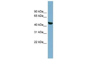 WB Suggested Anti-C22orf28 Antibody Titration: 0. (C22orf28 antibody  (N-Term))