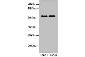 Western blot All lanes: TRIM17 antibody at 1 μg/mL Lane 1: U87 whole cell lysate Lane 2: K562 whole cell lysate Secondary Goat polyclonal to rabbit IgG at 1/10000 dilution Predicted band size: 55, 40 kDa Observed band size: 55 kDa (TRIM17 / RNF16 antibody  (AA 1-300))