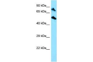 WB Suggested Anti-TOP1MT Antibody Titration: 1. (TOP1MT antibody  (C-Term))