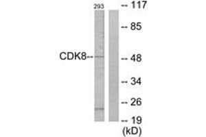Western blot analysis of extracts from 293 cells, using CDK8 Antibody. (CDK8 antibody  (AA 1-50))