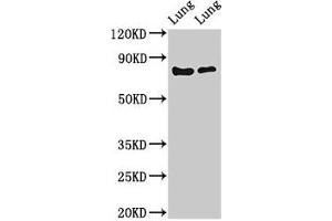Western Blot Positive WB detected in: Rat lung tissue, Mouse lung tissue All lanes: FOXP1 antibody at 2 μg/mL Secondary Goat polyclonal to rabbit IgG at 1/50000 dilution Predicted band size: 76, 55, 66, 75, 13, 67, 78 kDa Observed band size: 76 kDa (FOXP1 antibody  (AA 541-677))