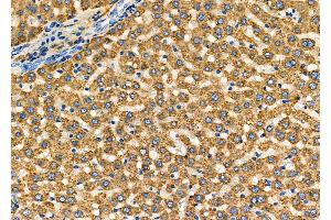 ABIN6261717 and ABIN6278027 at 1/100 staining Rat liver tissue by IHC-P. (FGA antibody  (C-Term))