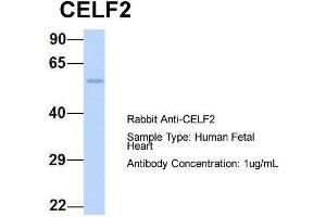 Host:  Rabbit  Target Name:  CELF2  Sample Type:  Human Fetal Heart  Antibody Dilution:  1. (CELF2 antibody  (N-Term))