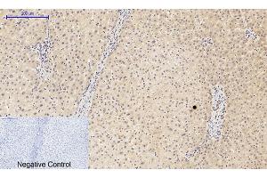 Immunohistochemical analysis of paraffin-embedded human liver tissue. (PIK3R1 antibody  (pTyr607))