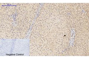 Immunohistochemical analysis of paraffin-embedded human liver tissue. (PIK3R1 antibody  (pTyr607))