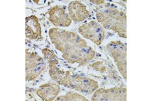 Immunohistochemistry of paraffin-embedded human stomach using PTCD3 antibody. (PTCD3 antibody  (AA 450-689))