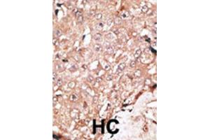 Immunohistochemistry (IHC) image for anti-Lysine (K)-Specific Demethylase 1A (KDM1A) antibody (ABIN2996581) (LSD1 antibody)