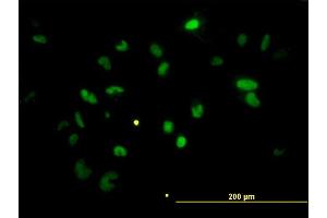 Immunofluorescence of monoclonal antibody to CHEK2 on HeLa cell. (CHEK2 antibody  (AA 1-543))