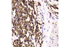 Immunohistochemistry (IHC) image for anti-Hematopoietic Cell-Specific Lyn Substrate 1 (HCLS1) (AA 1-280) antibody (ABIN3023094)