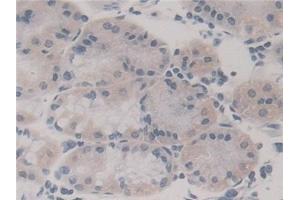 Immunohistochemistry (IHC) image for anti-Fission 1 (FIS1) (AA 1-117) antibody (ABIN7436618)