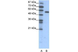 WB Suggested Anti-FOXC2 Antibody Titration: 1.