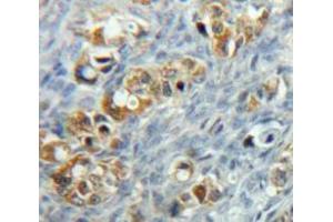 Used in DAB staining on fromalin fixed paraffin-embedded Ovary tissue (MCL-1 antibody  (AA 6-328))