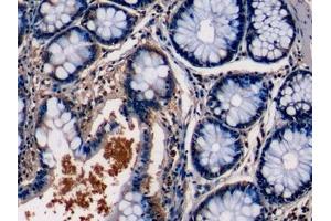 Detection of PKCe in Human Colon Tissue using Monoclonal Antibody to Protein Kinase C Epsilon (PKCe) (PKC epsilon antibody  (AA 403-672))