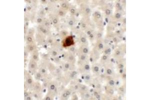 Immunohistochemistry (IHC) image for anti-Etoposide Induced 2.4 (EI24) (C-Term) antibody (ABIN1030379) (EI24 antibody  (C-Term))