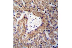 Immunohistochemistry analysis in formalin fixed and paraffin embedded human liver tissue reacted with GLYAT /  ACGNAT Antibody (Center) followed by peroxidase conjugation of the secondary antibody and DAB staining. (GLYAT antibody  (Middle Region))