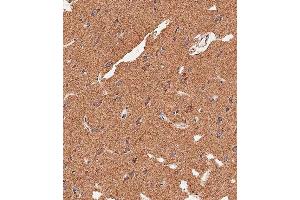 Immunohistochemical analysis of paraffin-embedded human brain tissue using (ABIN656416 and ABIN2845709) performed on the Leica® BOND RXm. (APG8b (AA 9-33), (N-Term) antibody)