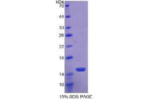 WB of Protein Standard: different control antibodies against Highly purified E. (TLR3 ELISA Kit)