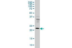RAB9A monoclonal antibody (M01), clone 1E12 Western Blot analysis of RAB9A expression in HeLa .