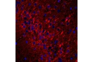 Immunofluorescent analysis of paraformaldehyde-fixed rat brain using,CD63 (ABIN7073400) at dilution of 1: 1500 (CD63 antibody)