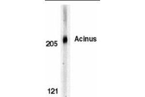 Western blot analysis of Acinus in K562 whole cell lysate with Acinus antibody (CT) at 0. (ACIN1 antibody  (C-Term))