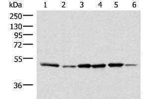 Western blot analysis of Jurkat PC-3 HepG2 Hela HT-29 and Raji cell lysates using IP6K1 Polyclonal Antibody at dilution of 1:400