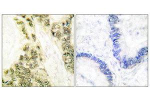 Immunohistochemistry (IHC) image for anti-Thyroid Hormone Receptor, alpha (THRA) (N-Term) antibody (ABIN1848805) (THRA antibody  (N-Term))