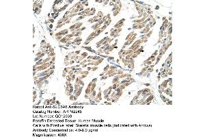 Rabbit Anti-SLC6A8 Antibody  Paraffin Embedded Tissue: Human Muscle Cellular Data: Skeletal muscle cells Antibody Concentration: 4. (SLC6A8 antibody  (N-Term))