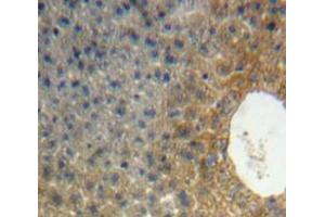 Used in DAB staining on fromalin fixed paraffin-embedded Liver tissue (APOH antibody  (AA 20-297))
