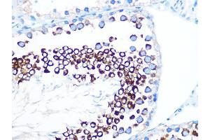 Immunohistochemistry of paraffin-embedded rat testis using FMRP Rabbit mAb (ABIN1679778, ABIN3019025, ABIN3019026 and ABIN7101703) at dilution of 1:100 (40x lens). (FMR1 antibody)
