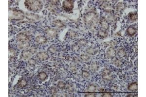 Immunoperoxidase of monoclonal antibody to STK38 on formalin-fixed paraffin-embedded human stomach. (STK38 antibody  (AA 365-465))