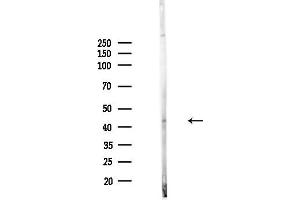 Western blot analysis of lysates from Hela cells(heat-shock,45 min treatment), using Phospho-Cyclin E1 (Thr395) Antibody at 1/1000 dilution.