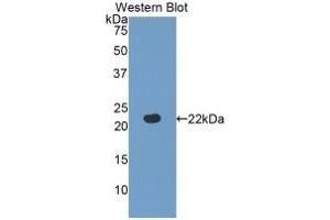 Detection of recombinant FBLN5 using Polyclonal Antibody to Fibulin 5 (FBLN5) (Fibulin 5 antibody  (AA 277-448))