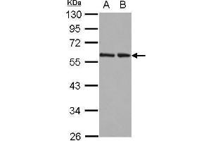 WB Image Sample (30 ug of whole cell lysate) A: 293T B: A431 12% SDS PAGE antibody diluted at 1:10000