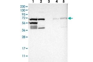 Western blot analysis of Lane 1: RT-4, Lane 2: U-251 MG, Lane 3: Human Plasma, Lane 4: Liver, Lane 5: Tonsil with TRIP4 polyclonal antibody . (TRIP4 antibody)